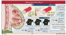 السعوديات فوق الـ 40 تحت مجهر الماموجرام 23 شوال